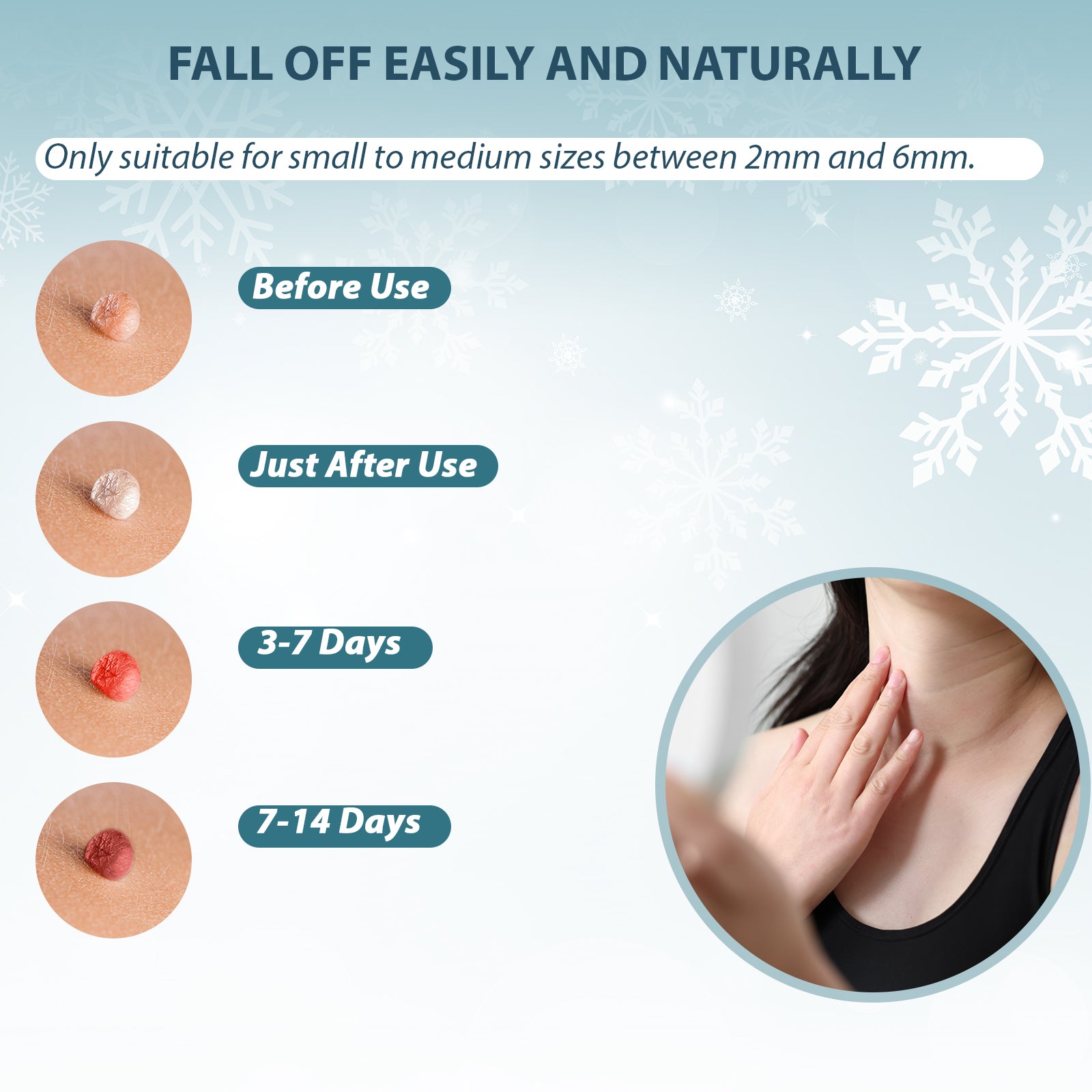 WA1000 Skin Tag Remover with Freeze Off Technology, Effective Skin Tag Removal Device, Home Use Cryo Kit for 1-2 Week Results + 10 Use Cycles